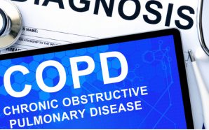 COPD Treatment: What Are Your Options?