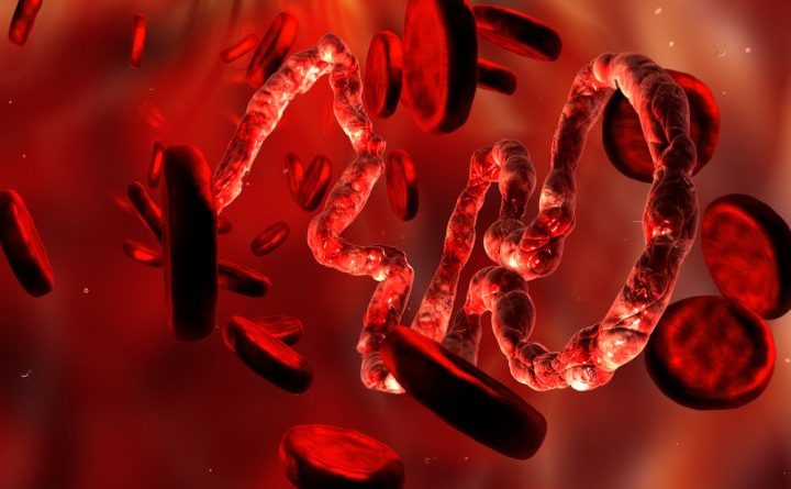 treatment of deep vein thrombosis