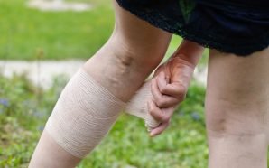 deep vein thrombosis prophylaxis