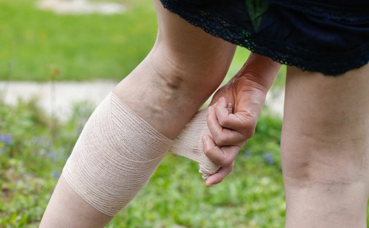 deep vein thrombosis prophylaxis