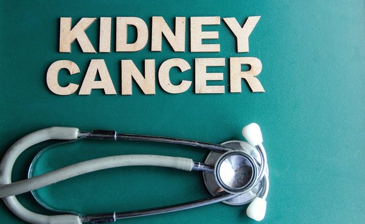 metastatic renal cell carcinoma treatment, renal cell carcinoma diagnosis, metastatic renal cell carcinoma, metastatic renal cell carcinoma treatments, What is Renal Cell Carcinoma Cancer?, metastatic renal carcinoma treatments, metastatic renal cell carcinoma diagnosis, renal cell carcinoma treatment, renal cell carcinoma, alternative kidney cancer treatment, advanced kidney cancer treatments, kidney cancer survival rates, treatment advanced kidney cancer, metastatic kidney cancer treatments, treatment for metastatic kidney cancer
