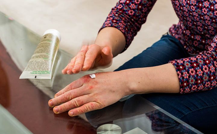 Atopic Eczema Relief