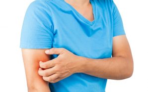 atopic eczema treatments