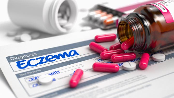 chronic eczema treatment