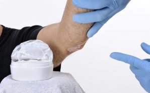 eczema ointment