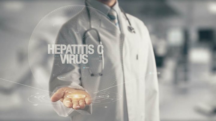 Hepatitis C