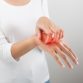 Atopic Dermatitis Eczema Treatments