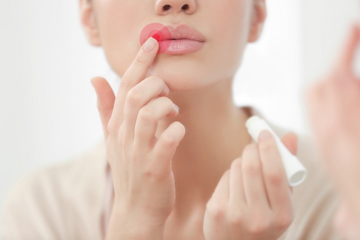 Valtrex herpes medication
