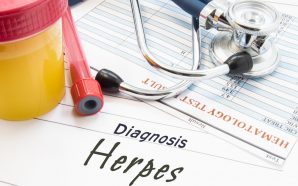 Herpes Test