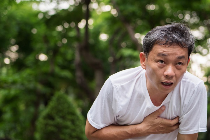 rheumatoid arthritis pulmonary fibrosis
