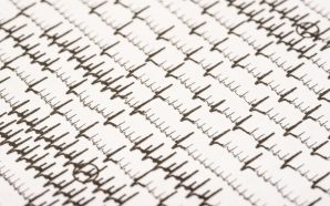 AFib Treatment: New Oral Drugs