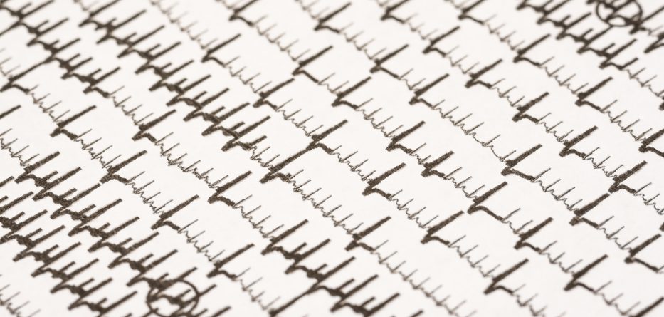 AFib Treatment: New Oral Drugs