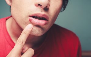 Herpes Medication